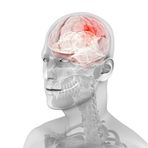 CNS Pharmaceuticals, Inc.