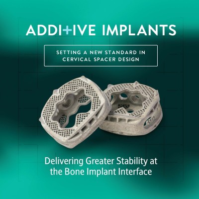 Additive Implants