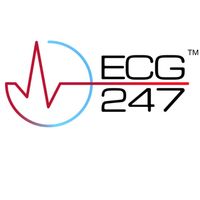 ECG247 - Smart Heart Sensor