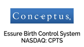 Essure