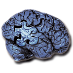 Cerebral Hack